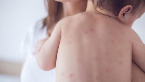 УЛААНБУРХАН ӨВЧНИЙ ХАВЬТЛЫН ТОО 7220 БОЛЖЭЭ